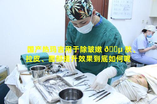 国产热玛吉用于除皱嫩 🌵 肤、拉皮、面部提升效果到底如何呢 🕊